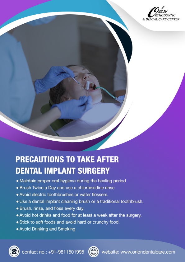 dental-implant-in-delhi