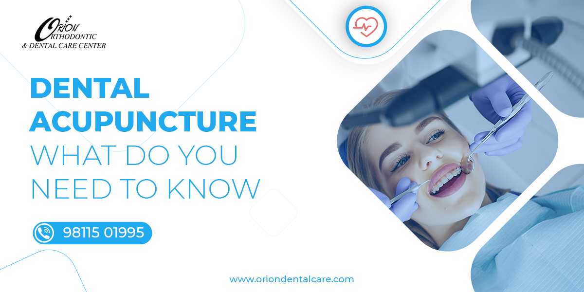Read more about the article Dental acupuncture: What do you need to know?
