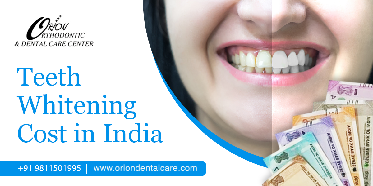 What is the cost of Invisalign in India? - Quora