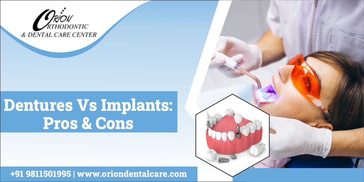 Read more about the article Dentures Vs. Implants: Pros & Cons