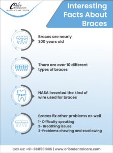 Fact About Dental Braces