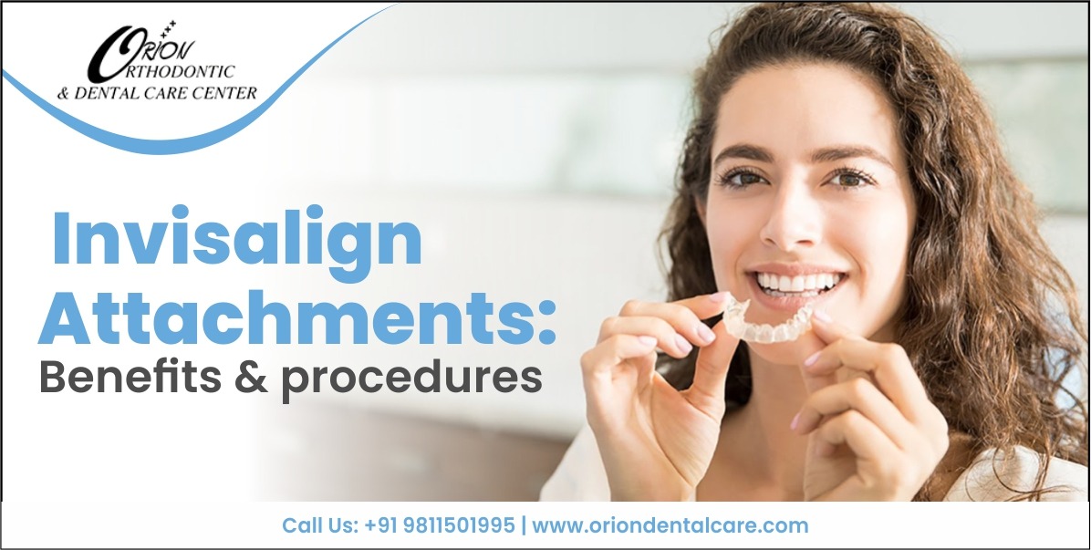 Read more about the article Invisalign attachments: Benefits & procedures