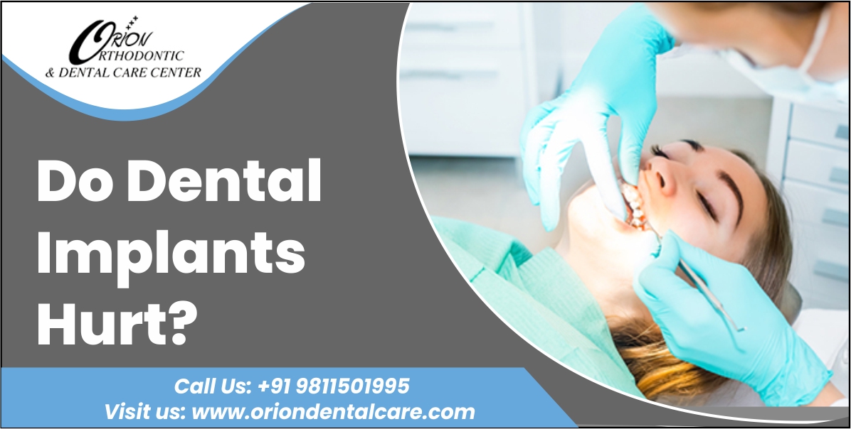 You are currently viewing Do dental implants hurt?