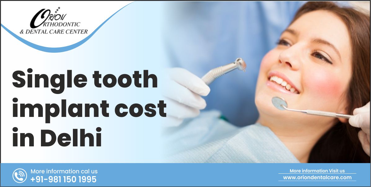 You are currently viewing Single tooth implant cost in Delhi