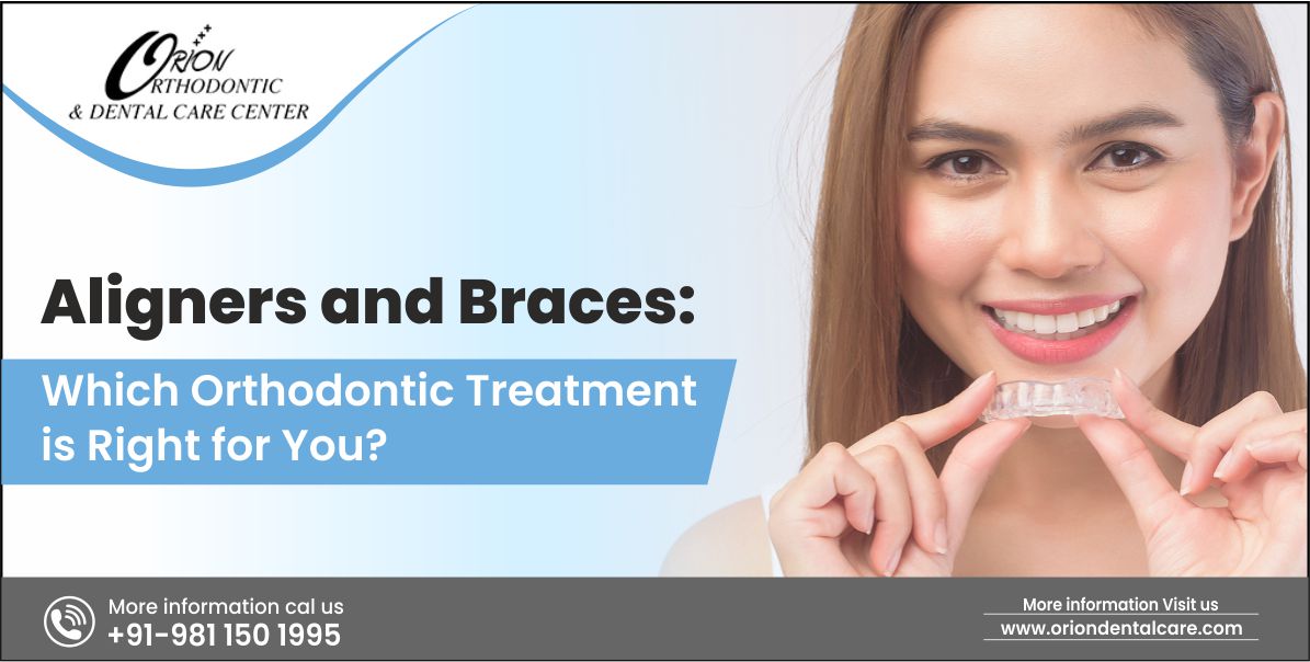 You are currently viewing Aligners and Braces: Which Orthodontic Treatment is Right for You?