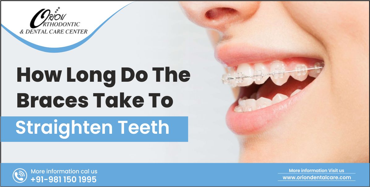 How long do the braces take to straighten teeth?
