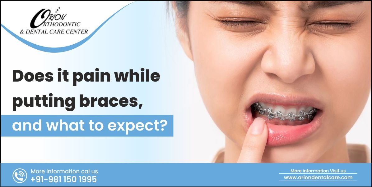 Does it pain while putting braces, and what to expect?