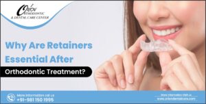 Read more about the article Why Are Retainers Essential After Orthodontic Treatment?