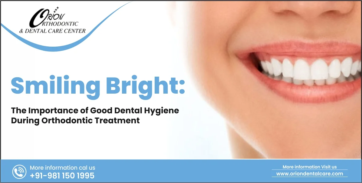 You are currently viewing Smiling Bright:- Importance of Good Dental Hygiene During Orthodontic Treatment