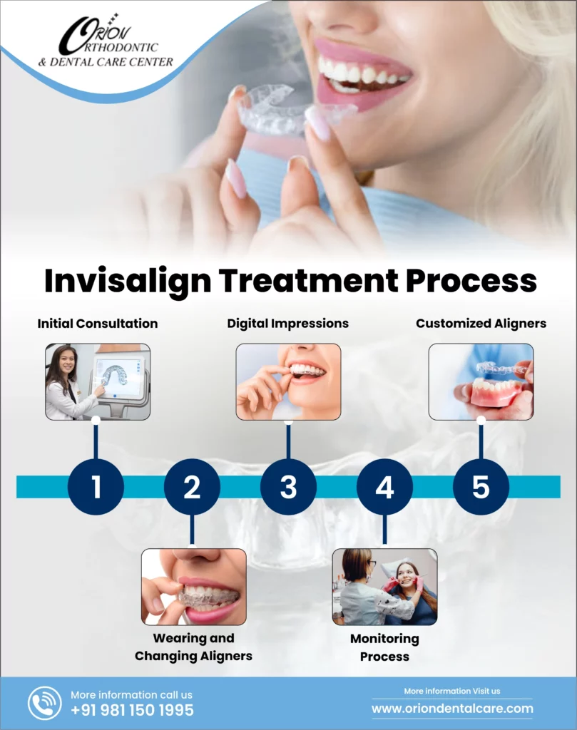 How Does Invisalign Works 
