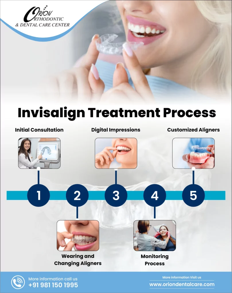 How Does Invisalign Works 