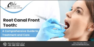 Read more about the article Root Canal Front Tooth: A Comprehensive Guide to Treatment and Care