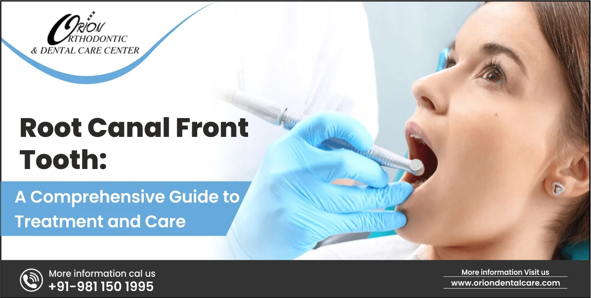 You are currently viewing Root Canal Front Tooth: A Comprehensive Guide to Treatment and Care