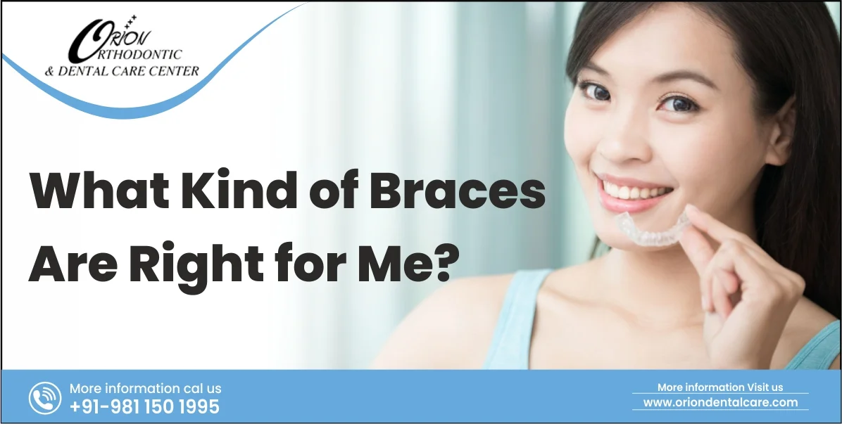 You are currently viewing What Kind of Braces Are Right for Me?