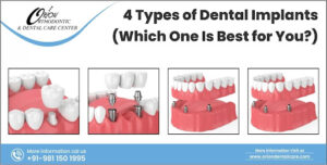 Read more about the article Types of Dental Implants (Which One Is Best for You?)