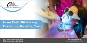 Read more about the article Laser Teeth Whitening: Procedure, Benefits, Costs