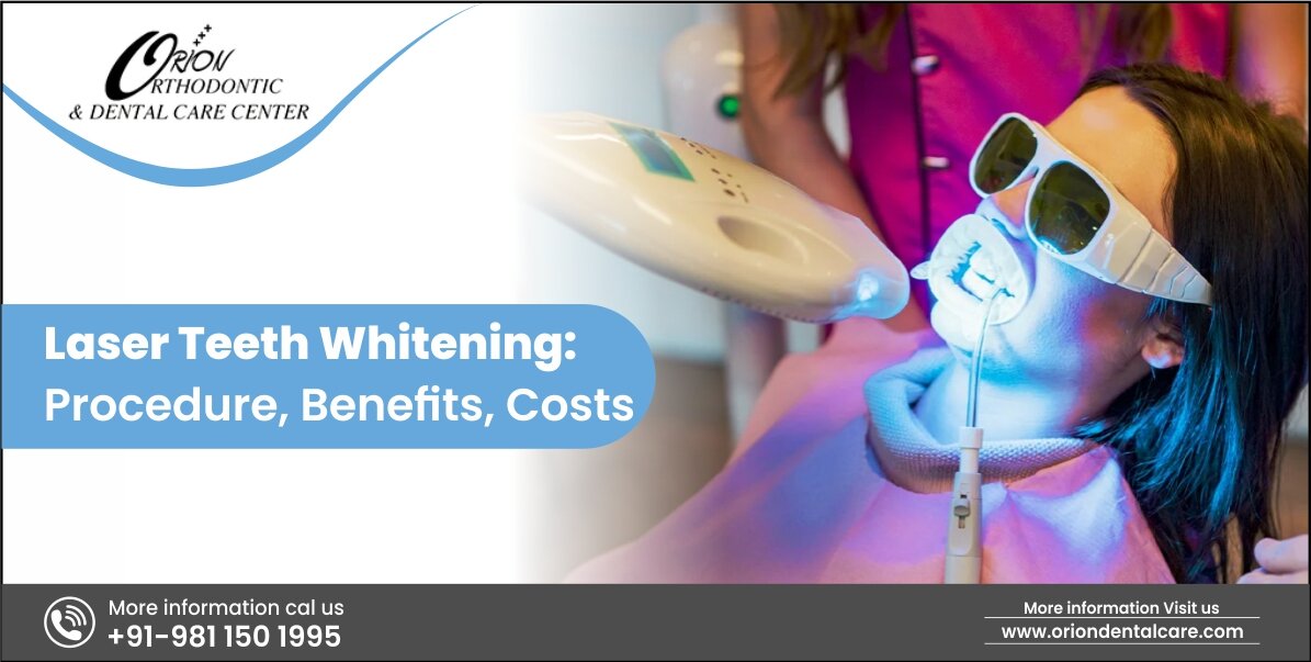 You are currently viewing Laser Teeth Whitening: Procedure, Benefits, Costs