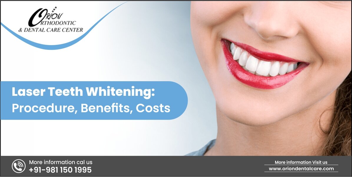 Read more about the article Teeth Whitening – Conventional Vs. Laser Whitening