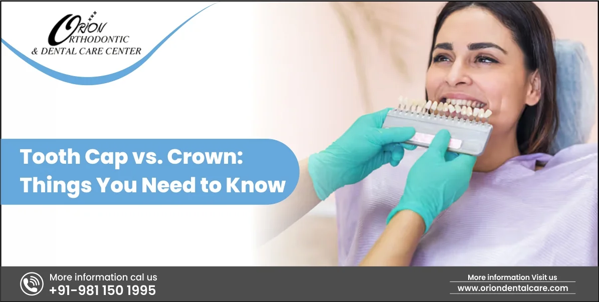 Read more about the article Tooth Cap vs. Crown: Things You Need to Know
