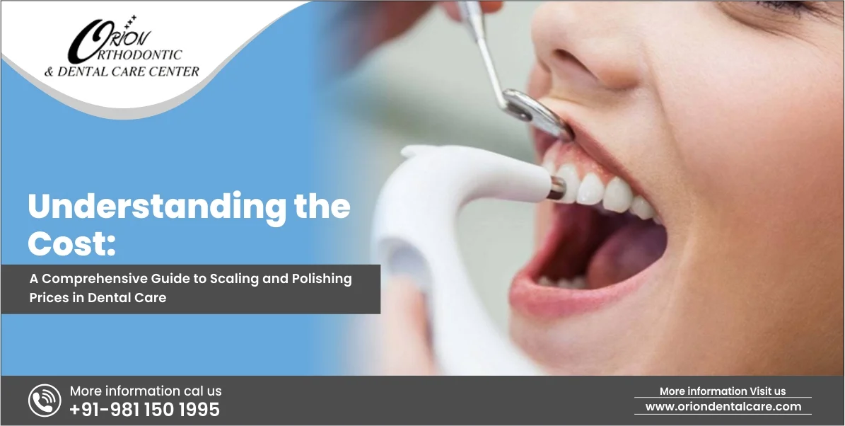 You are currently viewing Understanding the Cost: A Comprehensive Guide to Scaling and Polishing Prices in Dental Care