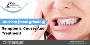Read more about the article Bruxism (Teeth Grinding) – Symptoms, Causes And Treatment