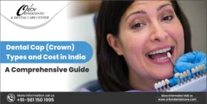 Read more about the article Dental Cap (Crown) Types and Cost in India – A Comprehensive Guide
