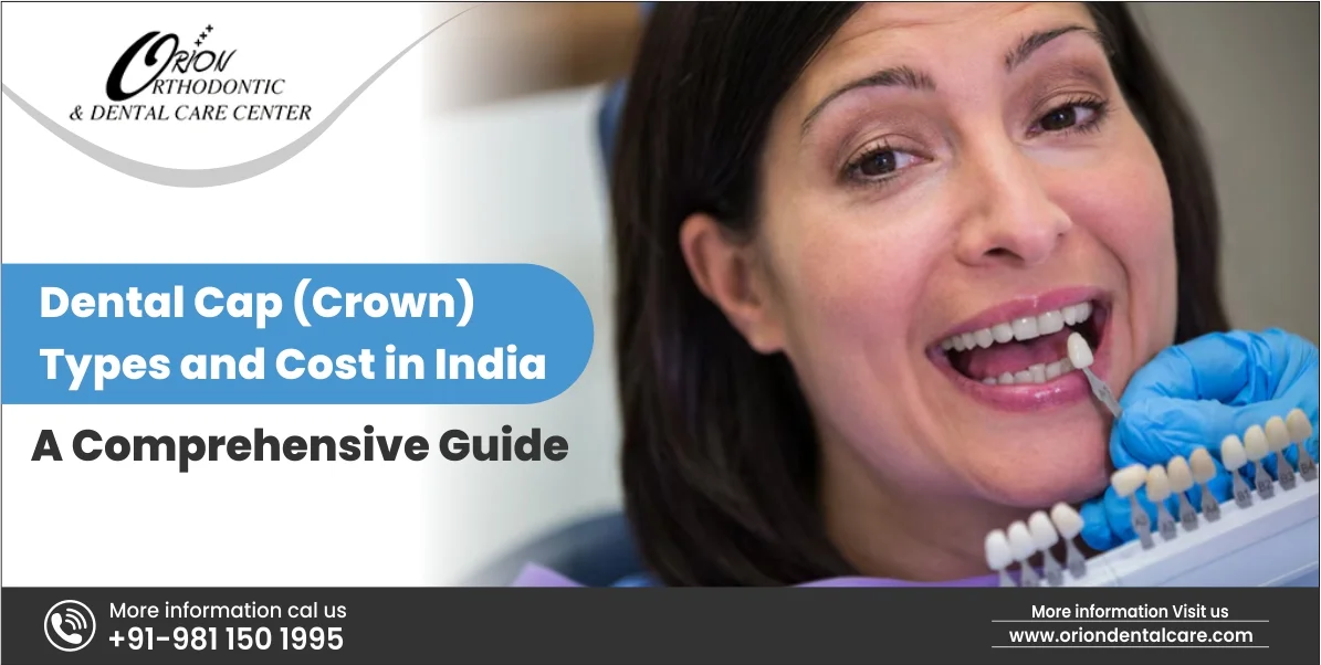 You are currently viewing Dental Cap (Crown) Types and Cost in India – A Comprehensive Guide