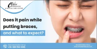 Does it pain while putting braces, and what to expect?