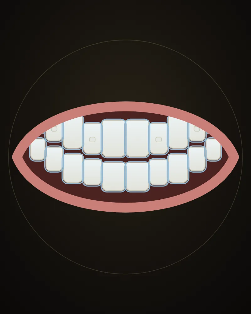 An illustration of a tooth with a clear aligner